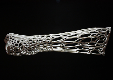 dezeen_Cortex-3D-printed-cast-for-broken-bones-by-Jake-Evill-3