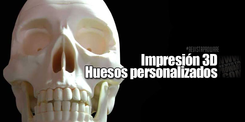huesos-personalizados-RVP