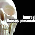Impresión 3D de huesos personalizados
